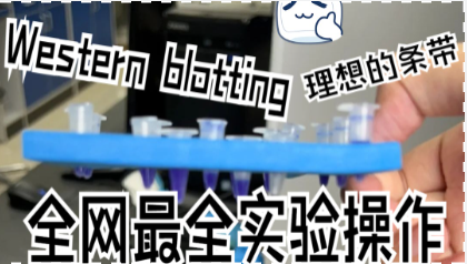 Western Blotting全网最全操作大公开！教你跑出干净理想的条带！