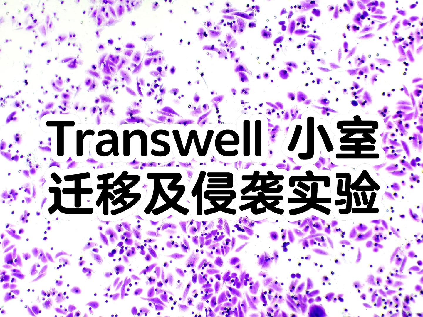 一文吃透Transwell实验！原理、类型、避坑全解析，新手也能零失误