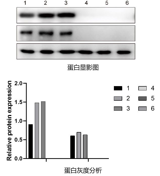 第二篇｜WB实验进阶：制胶、电泳与转膜（核心分离篇）