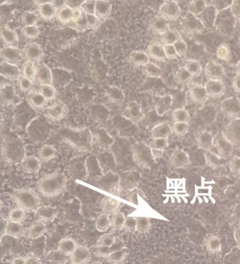 细胞镜下小黑点分不清？3 招快速区分细胞碎片与微生物污染