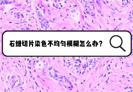 石蜡切片染色不均匀模糊怎么办？