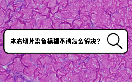 冰冻切片染色模糊不清什么原因？