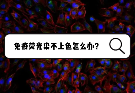 免疫荧光染不上色怎么办？