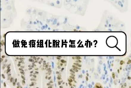 做免疫组化时脱片怎么办？