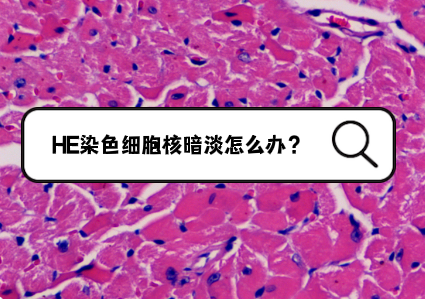 HE染色细胞核暗淡怎么办？