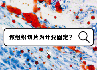 做组织切片为什要固定？如何固定？