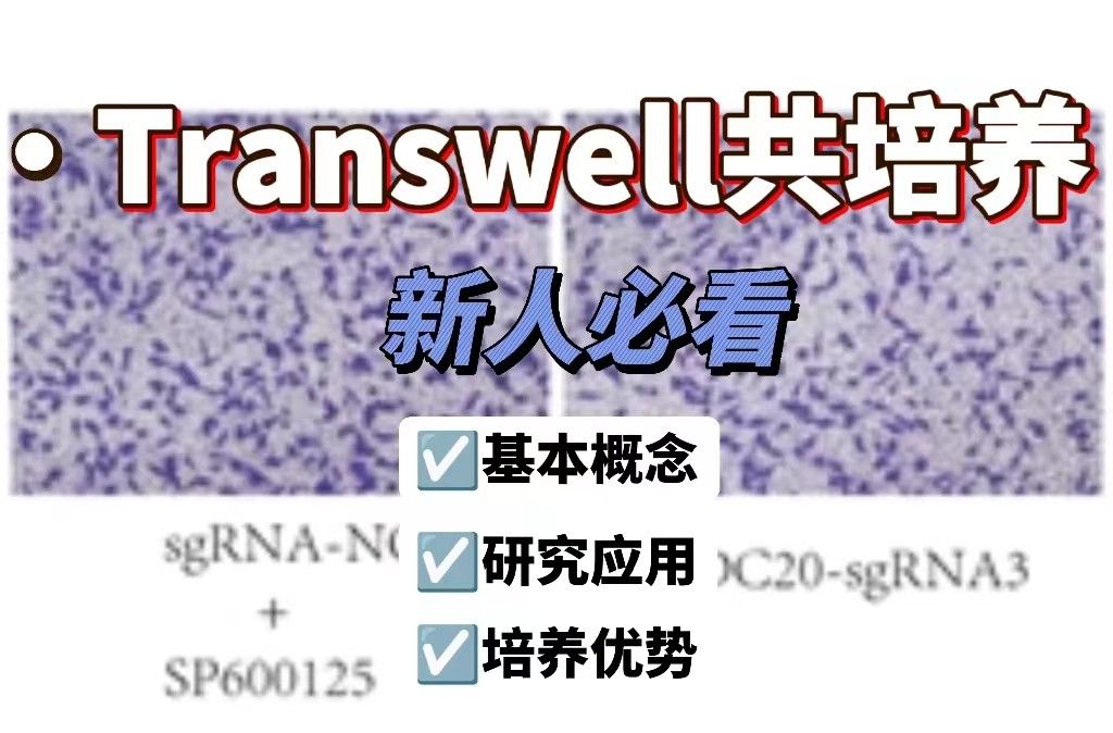 Transwell共培养【新人必看】