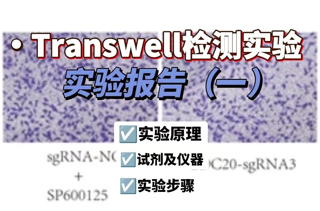 Transwell检测实验报告【整理】