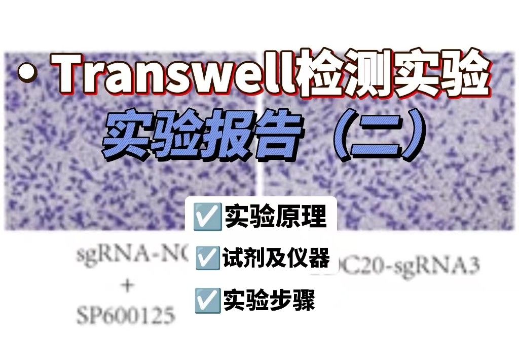Transwell迁移实验报告【新人必看】