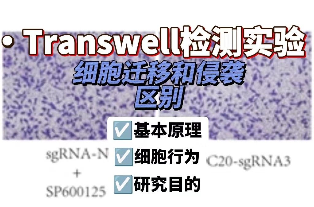 Transwell迁移和侵袭的区别