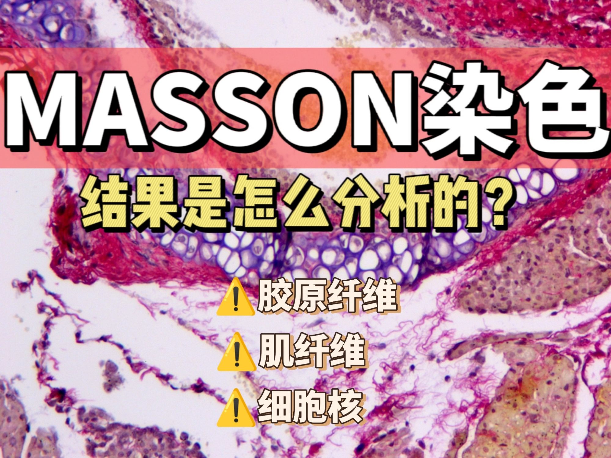 MASSON（马松）染色结果怎么分析的？【科研干货】