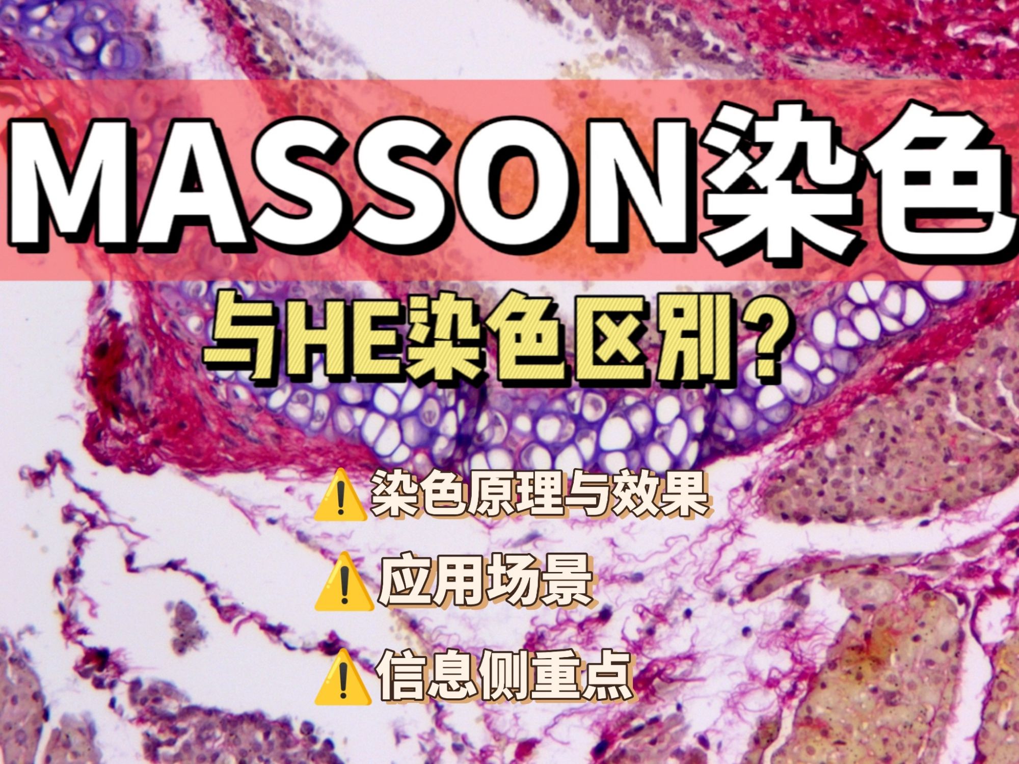 MASSON染色和HE染色区别?