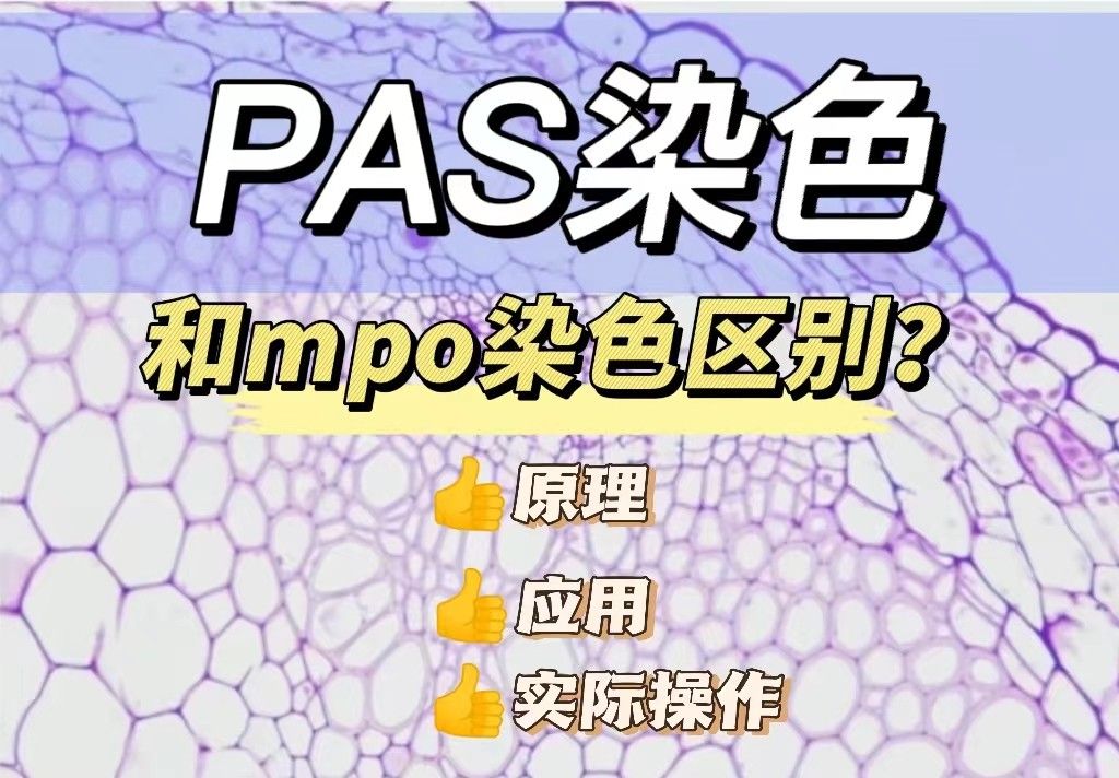 PAS染色和mpo染色区别是什么？