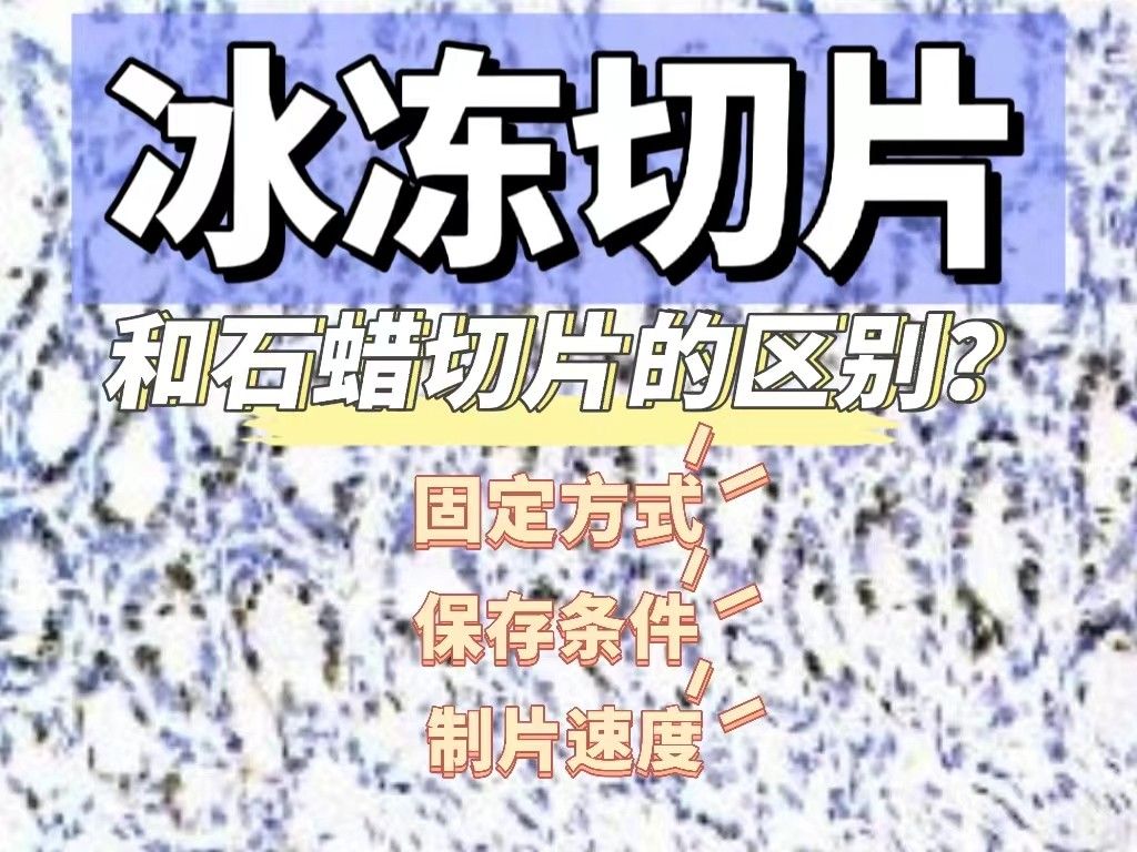 冰冻切片和石蜡切片的区别是什么？