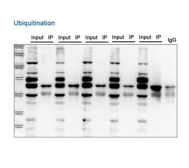 蛋白质泛素化（Ub）修饰