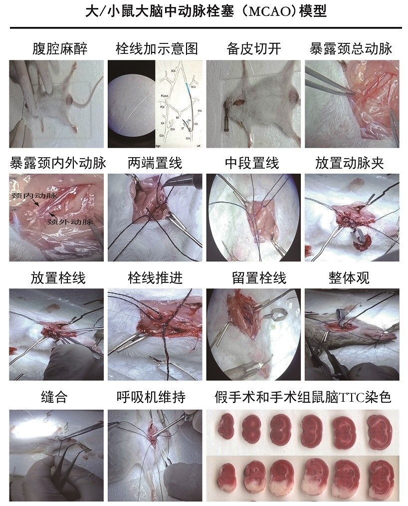 大 / 小鼠大脑中动脉栓塞 (MCAO) 模型