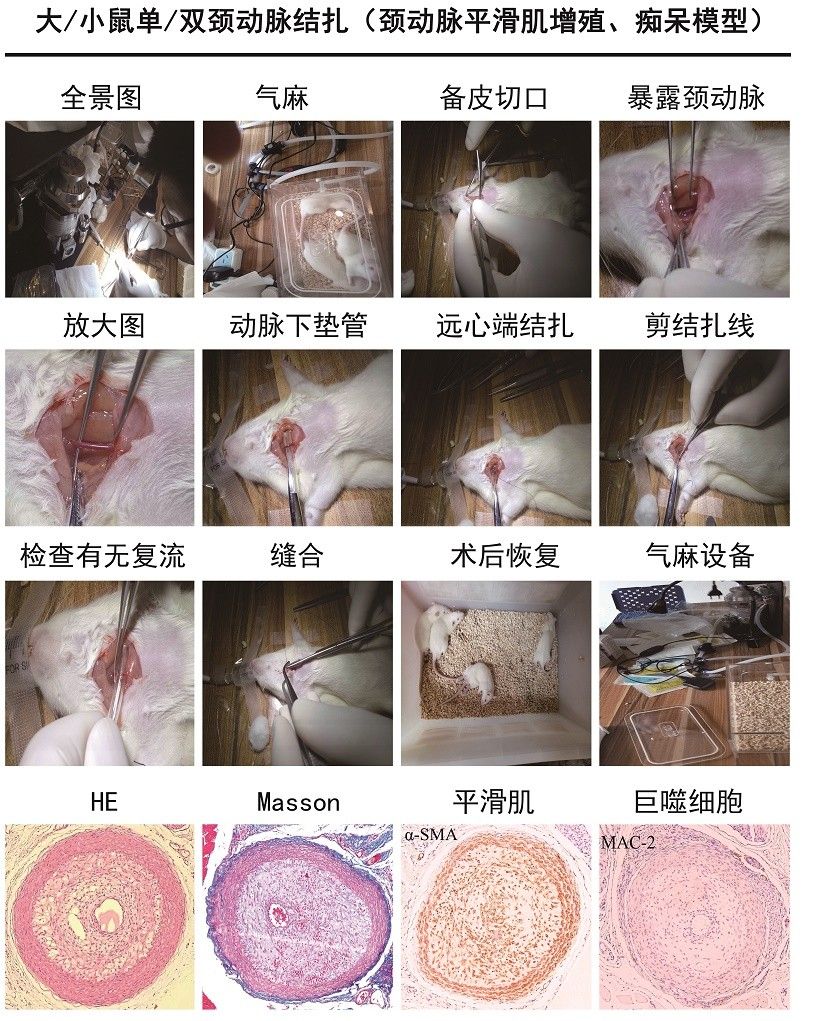 颈动脉平滑肌增殖 、痴呆模型 