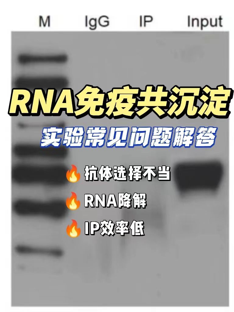 RNA免疫沉淀（RIP）实验常见问题解答