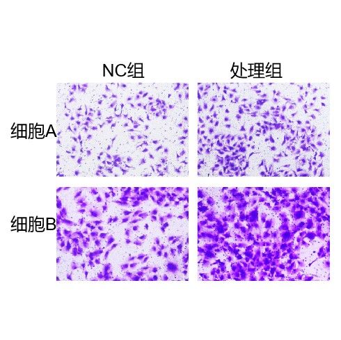 Transwell细胞迁移