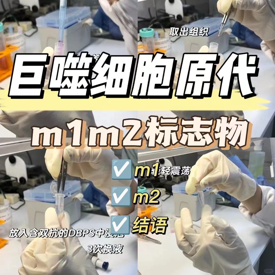 巨噬细胞m1m2标志物