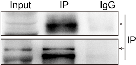 小鼠肝组织CO-IP