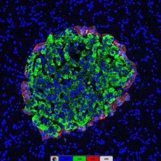 免疫荧光三标胰岛组织