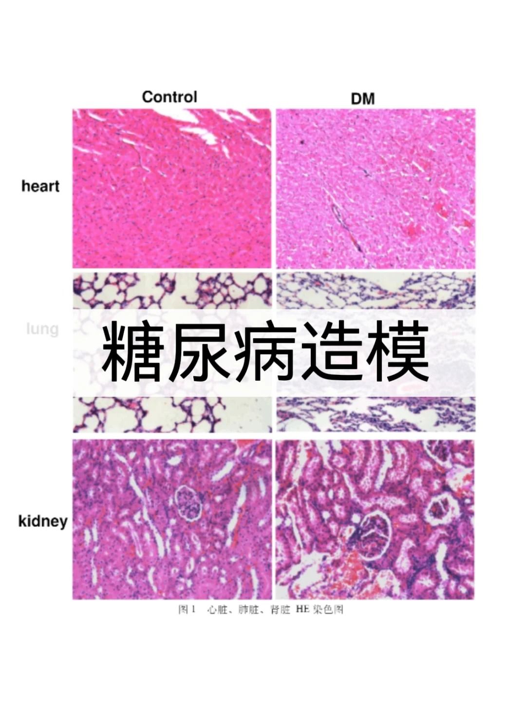 糖尿病肾病动物模型选择指南 (科研必备)