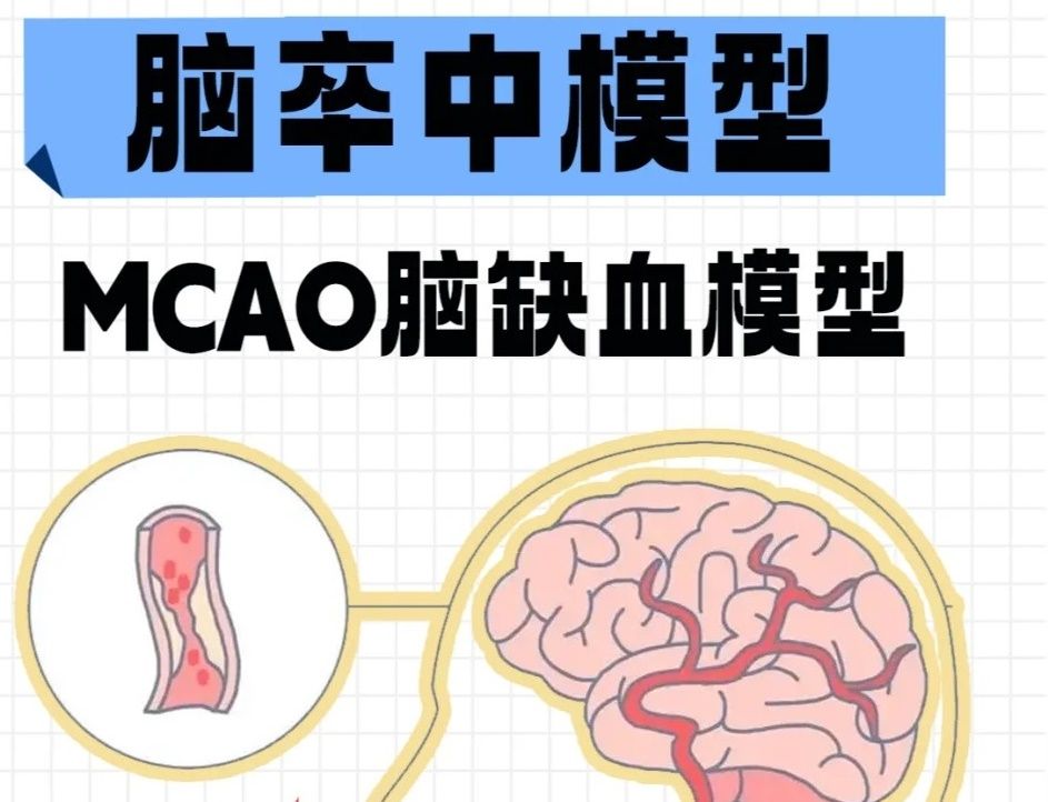 脑缺血动物模型构建实验注意事项