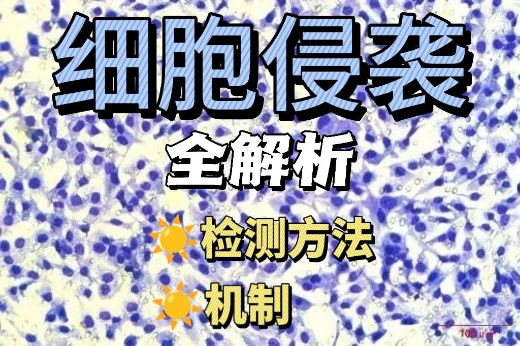 细胞侵袭：机制、检测方法与研究进展全解析