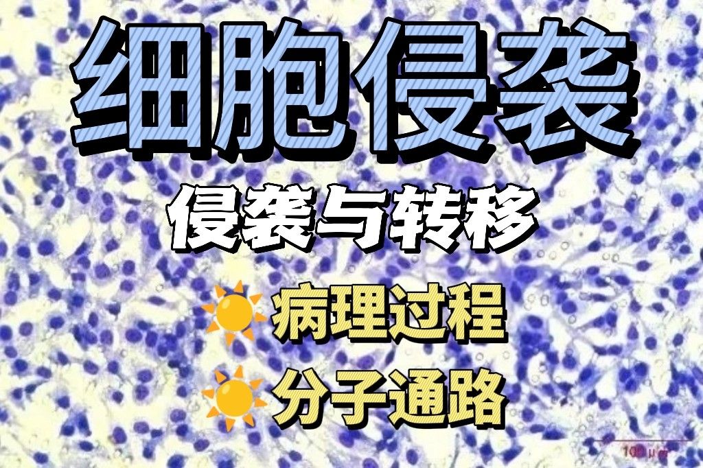 细胞侵袭与转移的关系：关键分子通路及治疗靶点研究