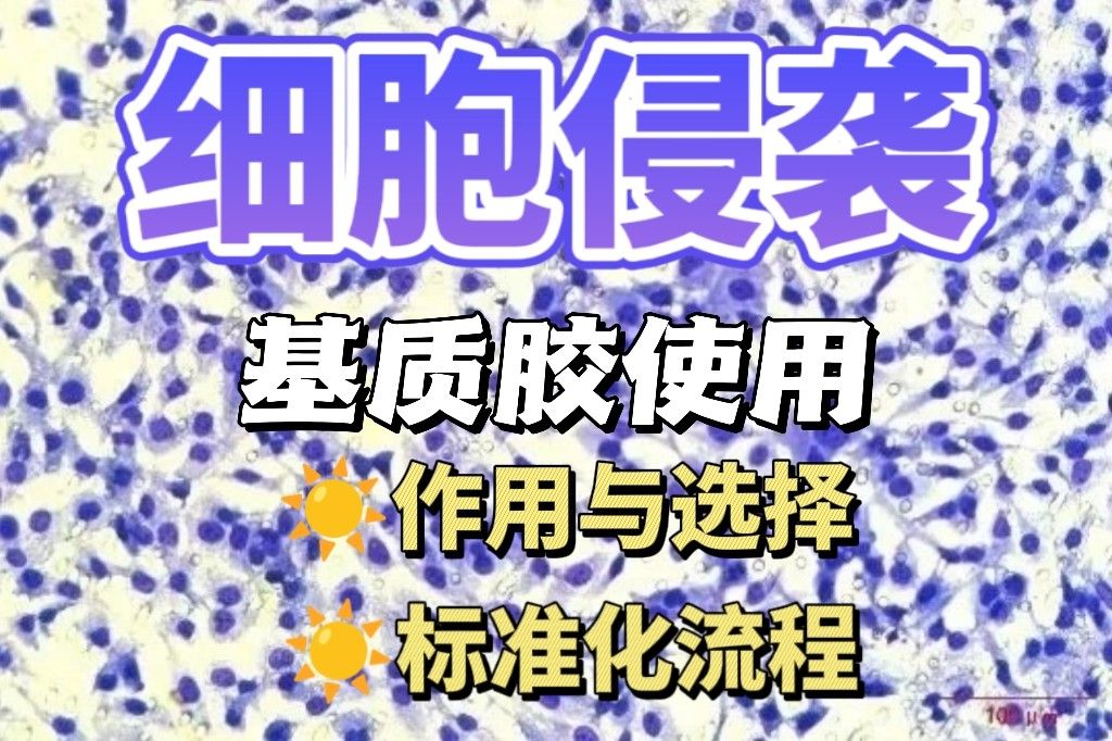 间充质干细胞侵袭性调控机制：微环境因子与信号通路研究进展