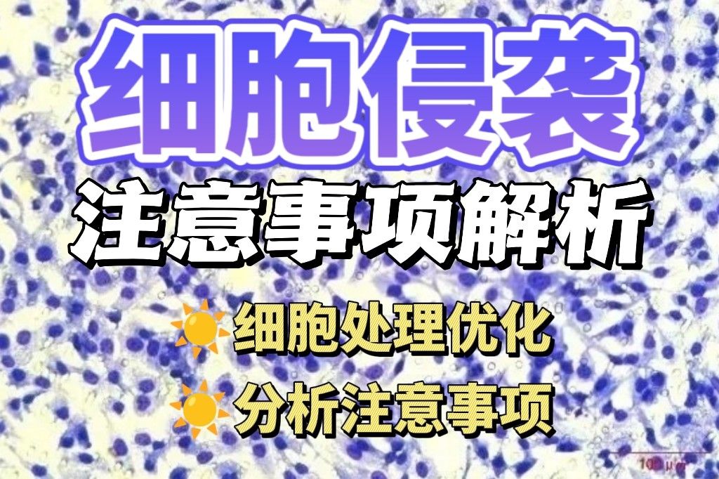 细胞侵袭实验注意事项