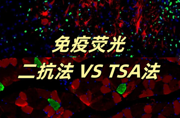 二抗法与TSA 法：免疫荧光实验方法怎么选？看完这篇就懂