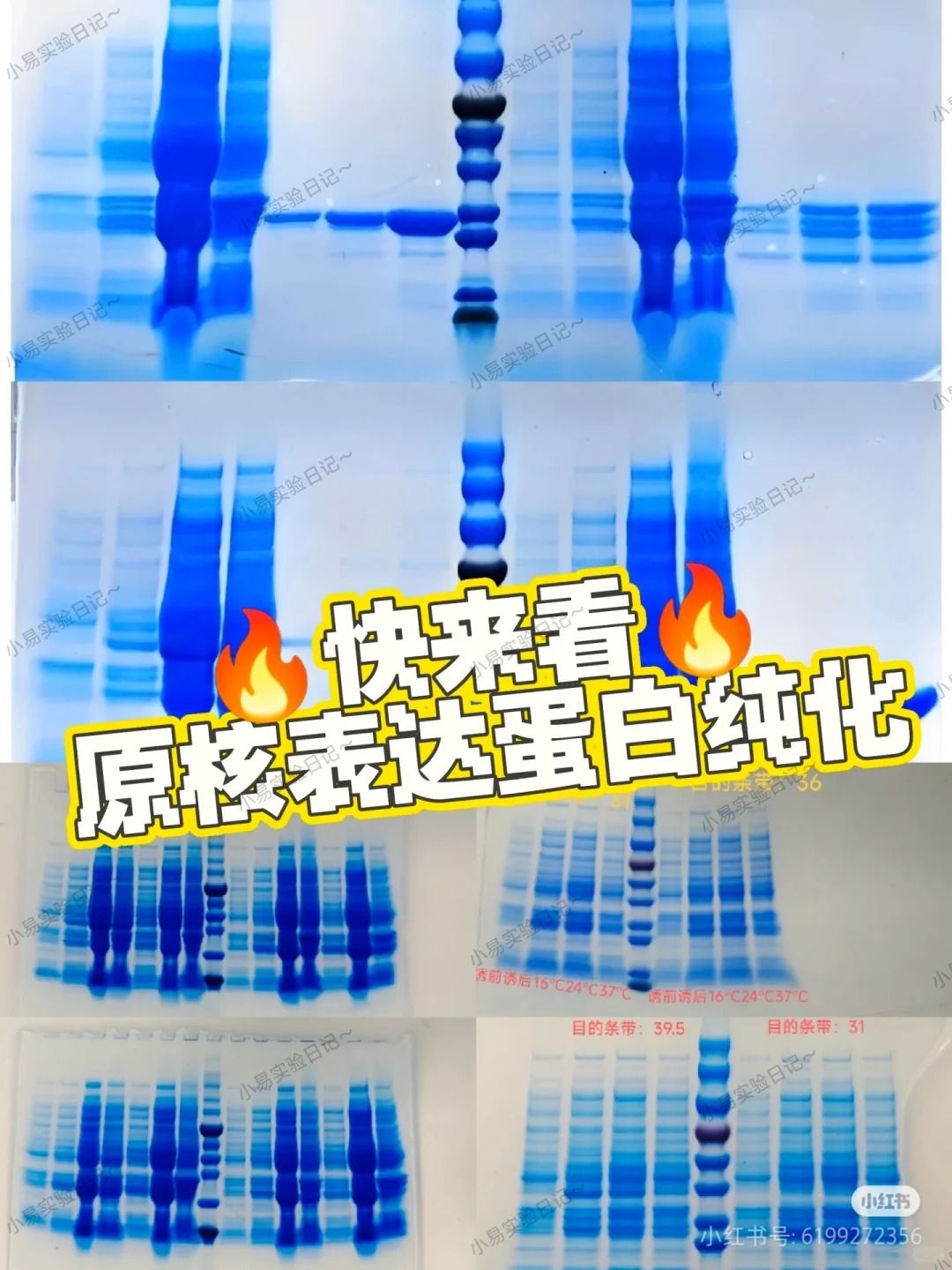 蛋白原核表达-从原理到实操超详细教程【蛋白表达】