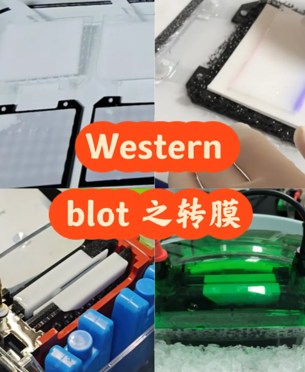 WB 转膜后怕白做？3 种快速判断蛋白转印的方法