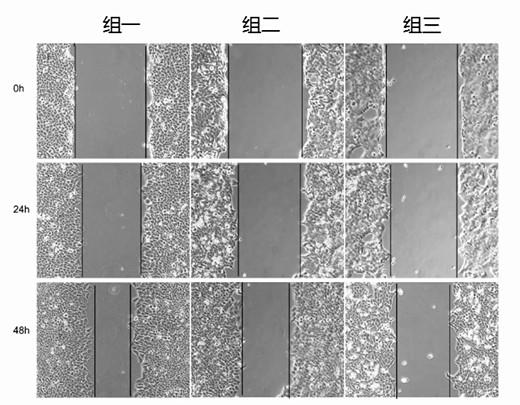 细胞划痕2.jpg